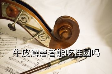 牛皮癬患者能吃桂圓嗎