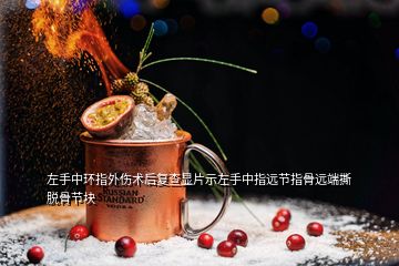 左手中環(huán)指外傷術后復查顯片示左手中指遠節(jié)指骨遠端撕脫骨節(jié)塊